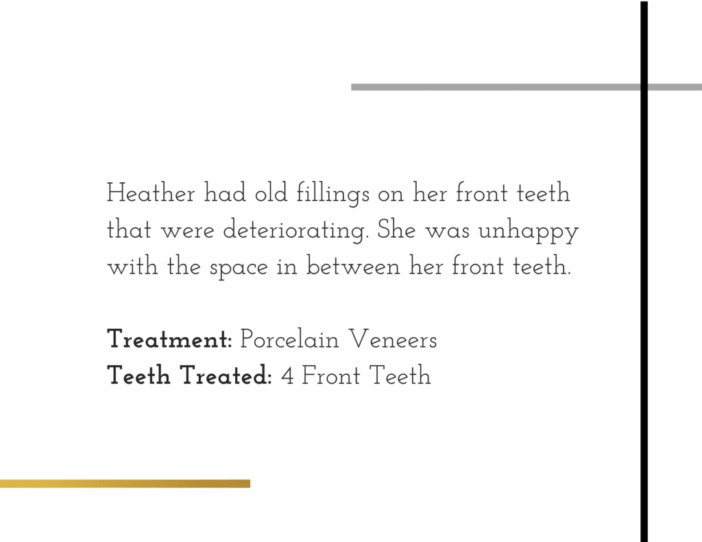 Details about porcelain veneer patient named Heather