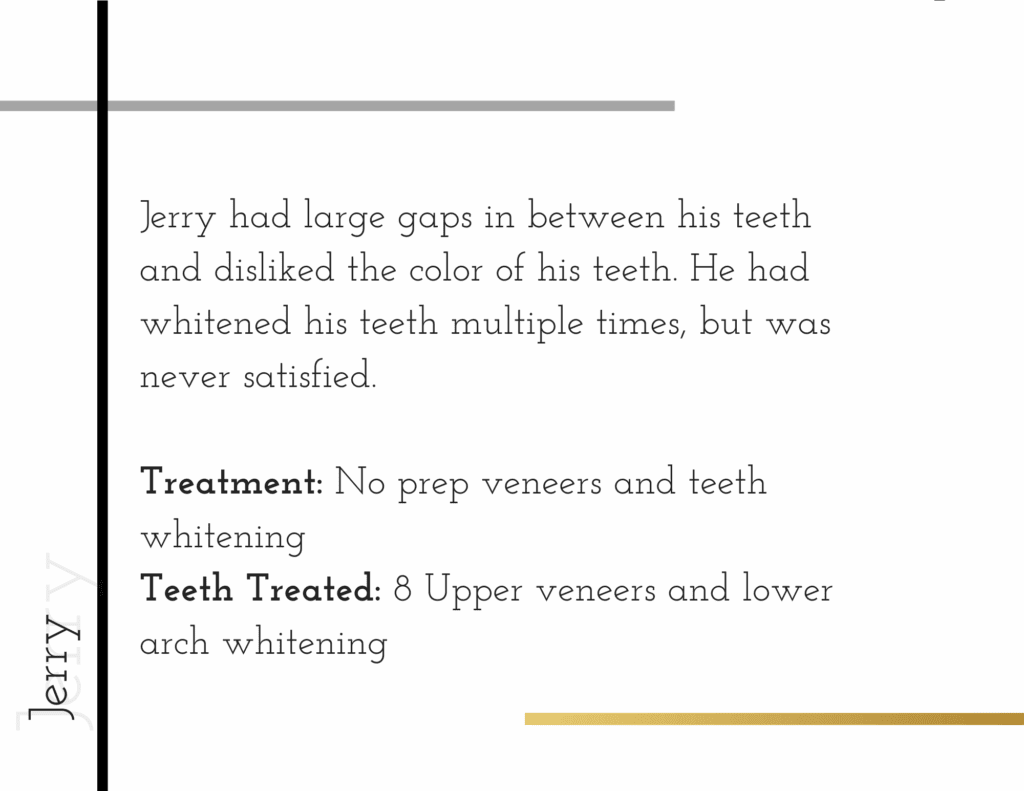 Details about porcelain veneer patient named Jerry