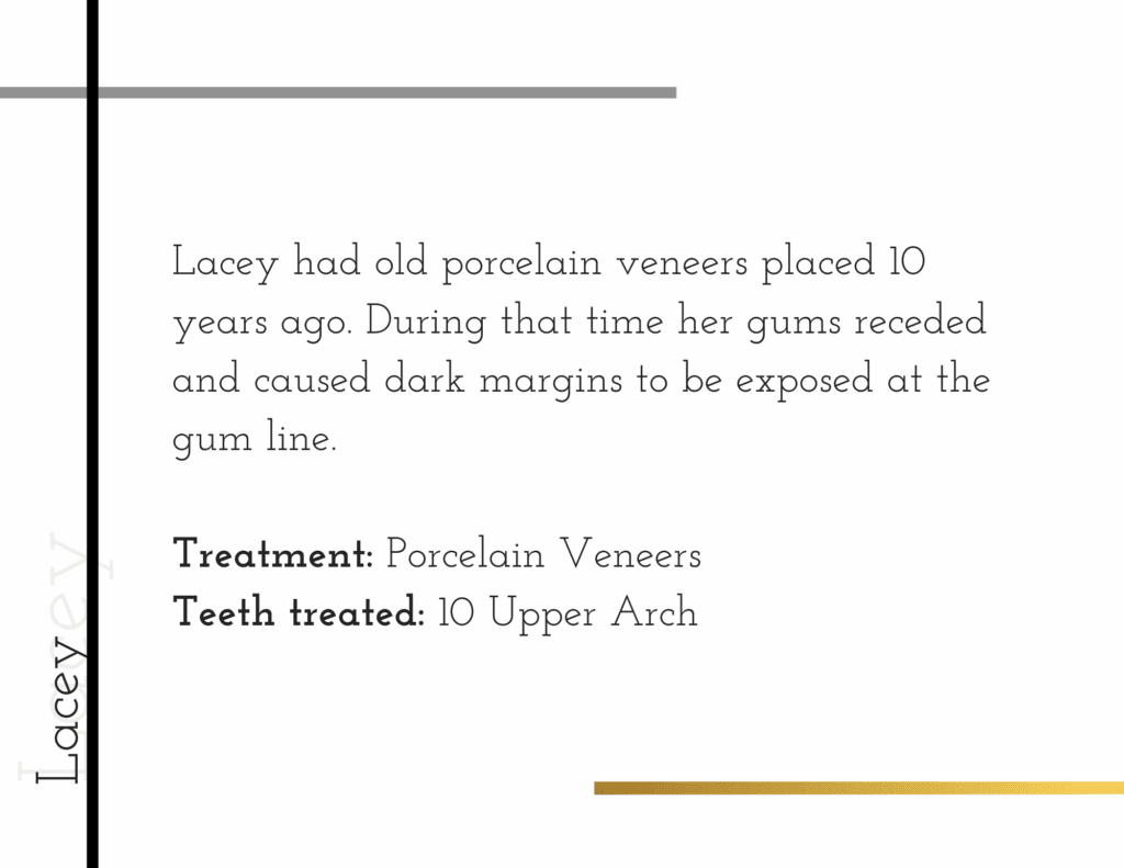 Details about porcelain veneer patient named Lacey