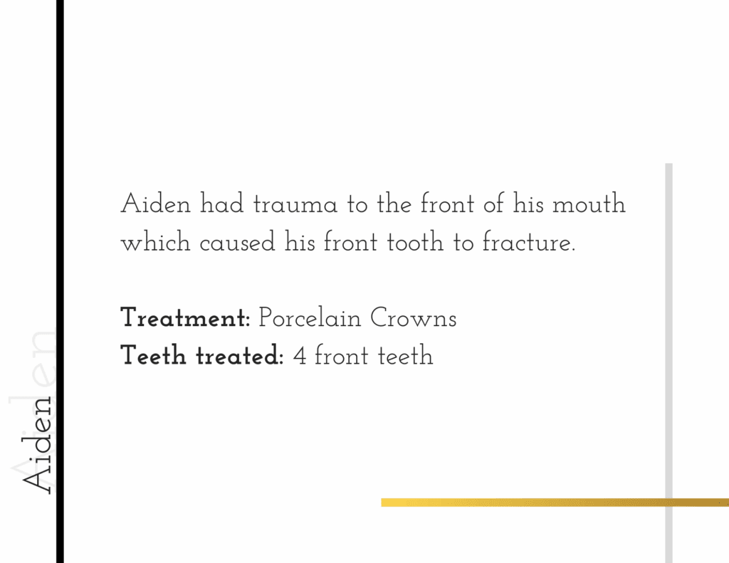 Porcelain crown treatment details for patient Aiden