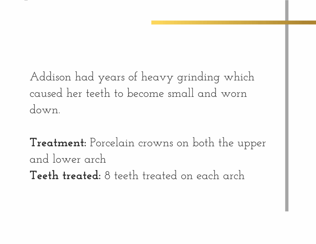 Porcelain crown treatment details for patient Maddison