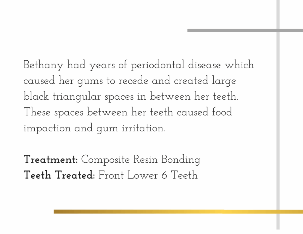 Composite resin bonding treatment details for patient Anthony