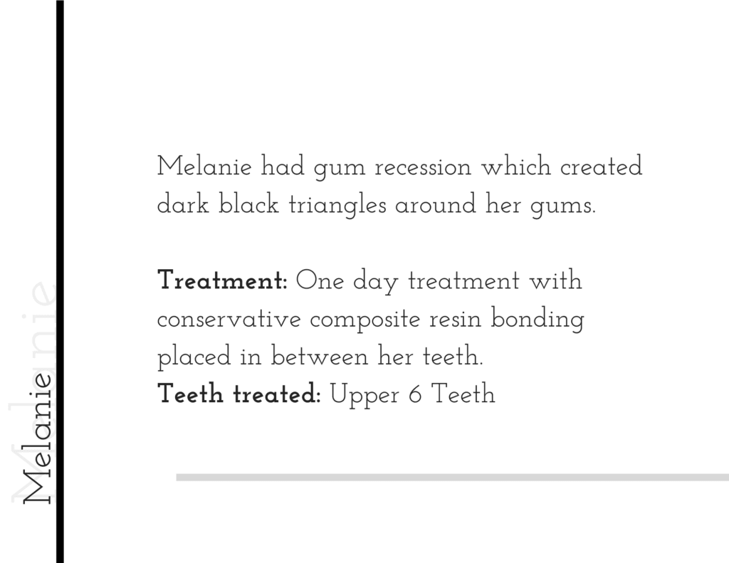 Composite resin bonding treatment details for patient Melanie