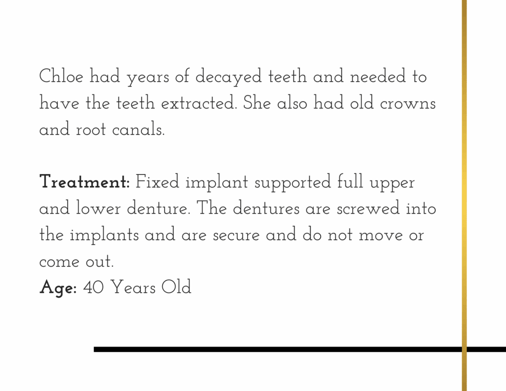 Decoyed teeth treatment details for patient Chloe